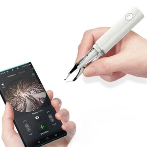 Hair Removal Tweezer with 1080p Camera, Ultimate Precision: Tweezer with Came... - Picture 1 of 7