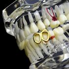 14K Gold Plated Double Open Fang Grillz Bottom Left Canine 2 Tooth Vampire Fangs