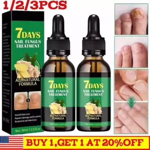Ginger Nail Treatment Nail Care, Nail Growth Oil for Cuticle Nourishment New~ - Picture 1 of 13