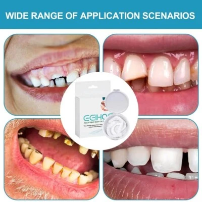 Snap On False Teeth Instant Smile Top and Bottom Fake Teeth Dental Veneers