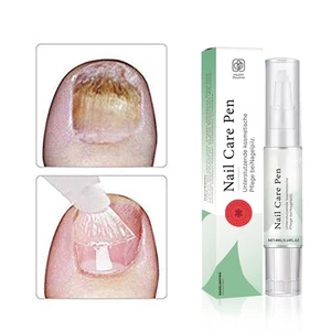 La pluma original para hongos en uñas Austria, pluma para el cuidado de las uñas rutina de salud para hongos en las uñas - Imagen 1 de 19