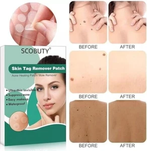 Skin Tag Removal Patches,Mole Remover,Skin Tag Remover Patch Cover Conceal 120qt - Picture 1 of 6