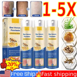 Bienengift Psoriasis Behandlung Spray, Psoriasis Linderung beruhigendes Spray 20 ml [ - Bild 1 von 11