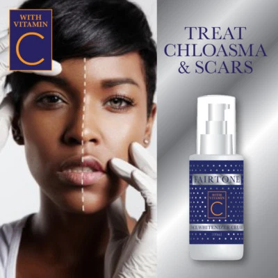 FAIRTONE FACE WHITENIZER CREAM WITH VITAMIN C WHITER SKIN NO SCARS PATCHES