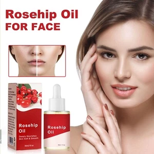 Facial Moisturizing Rose Fruit Serum Oil Body Skin Massage Nourishing Care Serum - Picture 1 of 10