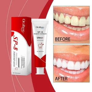 120g SP-8 Probiotic Toothpaste,Toothpaste Whitening Toothpaste 2024 Whit丨DE - Bild 1 von 12