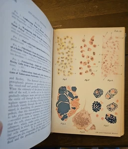 Rare Antique Medical Book Atlas and Epitome of General Pathologic Histology - Picture 1 of 8