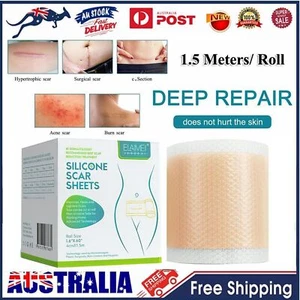 1.5M/Roll Silicone Gel Sheet Patch Scar Removal Wound Skin Repair Treatment Tape - Picture 1 of 12
