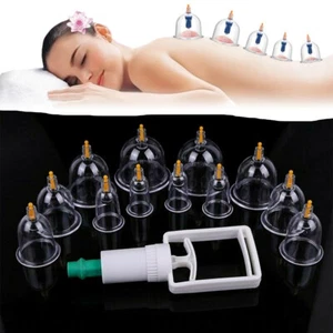 12 Cupping Therapy Cups Set Healthy Chinese Medical Vacuum Suction Body Massager - Picture 1 of 12