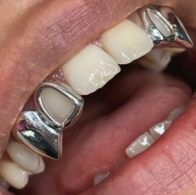 Custom Fit Silver Upper Top Teeth Double Open Face Vampire Fangs Grillz 2pc Set - Image 1 of 3