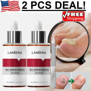 2 Bottle Anti Fungal Nail Treatment Nail Finger Toe Fungus Onychomycosis Remover - Picture 1 of 14