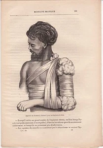 Alte medizinische Gravur 39 - Praktische Medizin - Gerät von Dr. A. Richard - Bild 1 von 1