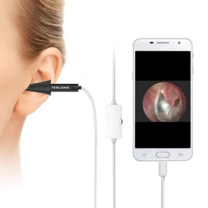 Teslong NTE100 Digital Otoscope Endoscope Ear Scope Camera Wax Clean - Picture 1 of 7