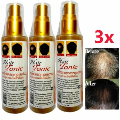 GENIVE HAIR TONIC Stop Reduce Hair Loss Create New Hair Replacement 120ml.3X  - Imagem 1 de 4