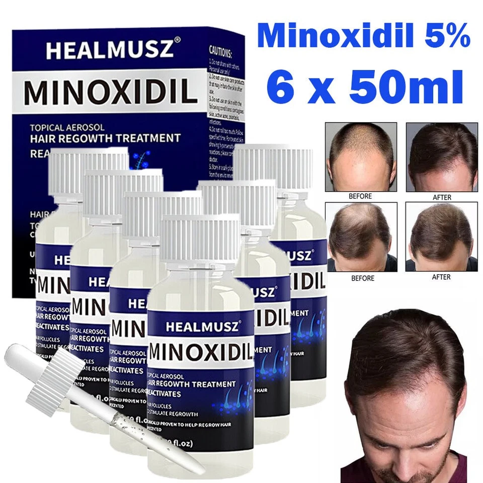 6 Pack Minoxidil 5% Extra Strength Men Hair Regrowth Treatment 6 Month Supply - Image 1 of 4