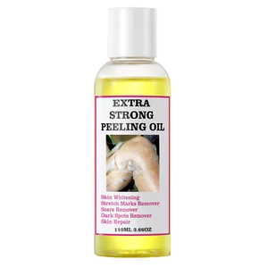 Strong Yellow Peeling Oil Exfoliating Solution for Face Body Dark Skin Knuckles - Picture 1 of 12