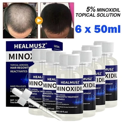 6 Pack Minoxidil 5% Extra Strength Men Hair Regrowth Treatment 6 Month Supply - Image 1 of 4