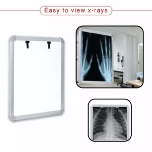 LED X-Ray View Box with Automatic Film Activation (Size-14X17 Inch) - Picture 1 of 7