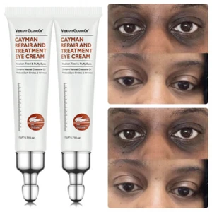 2PCS Eye Cream Firm Eye Tightener Remove Eye Bags Dark Circles Wrinkle Depuffing - Picture 1 of 14