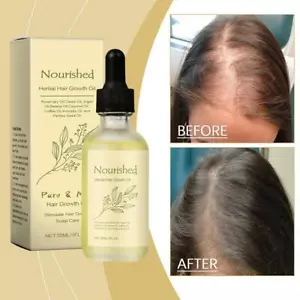 30ml Natural Hair Oil For Hair Growth | Promotes Hair Growth & Minimizes Hair^ - Picture 1 of 12