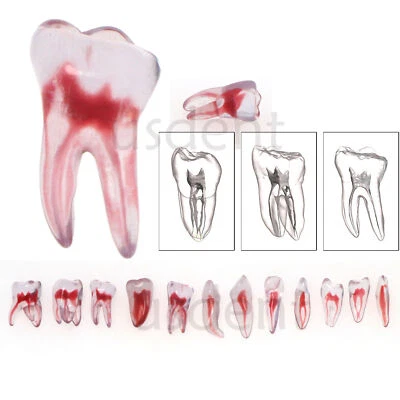 Entrenamiento Dental 3D ECA Endo Diente Modelo Práctica Modelo Curvo Raíz Resina Dientes Foto 1 de 4
