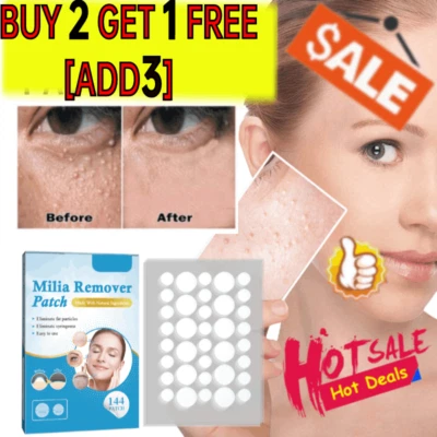 144 pcs Milia Remover Patches for Milia Spot Wart Oil Bumps Treatment Skin-UK✨ - Image 1 of 4