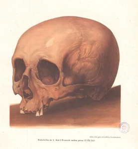 Impresión litográfica antigua alemana original del siglo XIX 1853 - Calavera - VII - Imagen 1 de 2