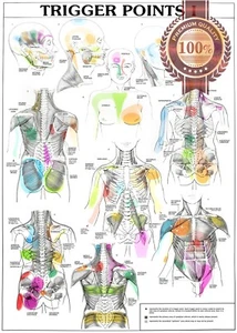 TRIGGER POINTS PART 1 ANATOMICAL DIAGRAM CHART ANATOMY PRINT PREMIUM POSTER - Picture 1 of 6