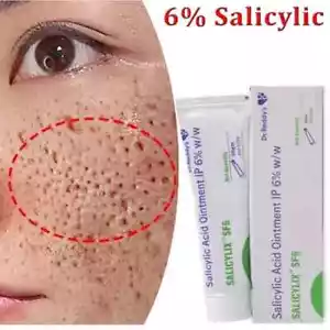 6% Salicylic Acid Acne Treatment Face Cream Remove Blackheads, Pores, Dark Spot. - Picture 1 of 5