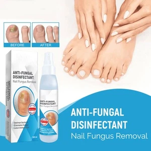 Nagelpflege Intensiv Nährt Spray, Tötet Pilz Beruhigt Juckreiz & Brennen 100ML - Bild 1 von 8