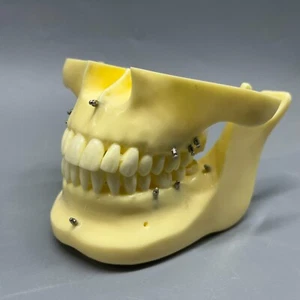 Dental practice implant model anchorage nail practice model - Picture 1 of 10