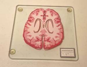 Brain Slide Coaster single Neuroanatomy Autopsy Pathology 4" pink histology ht - Picture 1 of 3