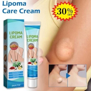 1 pcs Lipoma Soothing Cream Instant Ointment Relieving Discomfort Fat-Agglom|HOT - Picture 1 of 12