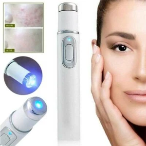 Acne Laser Pen Portable Wrinkle Skin Spot Vein Eraser Removal Spider Blue Light~ - Picture 1 of 12