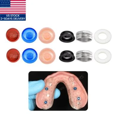 GOLDENKEY 2Set Dental Implant Overdenture Locator Abutments Retention Caps Insert US Stock