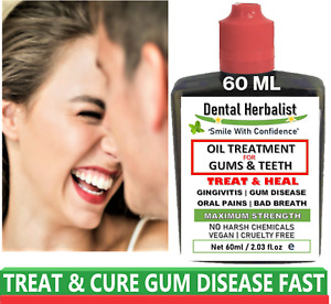 Anti Gingivitis Serious Gum Infection Periodontitis Bleeding Herbal Remedy 60 ML