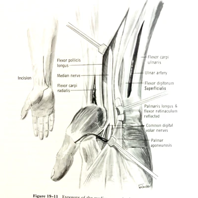 Vintage Management of Peripheral Nerve Problems Book Hardcover 1980 - Image 1 of 4