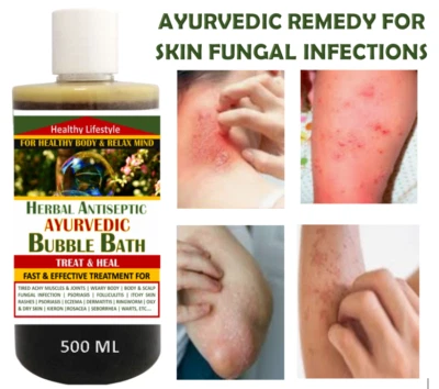 HEALTHY LIFESTYLE Antifungal Powerful Combats Fungal Infections - Bubble Bath Soak 500 Ml