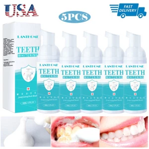 5X Tooth Whitening Foam Toothpaste Stains Removal Teeth Deep Cleansing Oral Care - Picture 1 of 12