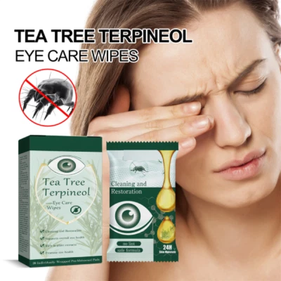 Eye Mite Removal Wet Wipes Tea Tree Oil Sensitive Dry Eyes Blepharitis Relief - Image 1 of 4
