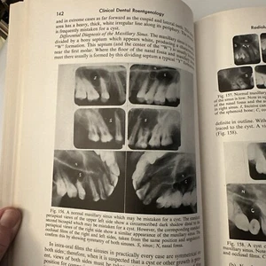 OLD X-RAY BOOK Clinical Dental Roentgenology Technic 1952 3rd Ed. ANTIQUE BOOK - Picture 1 of 24