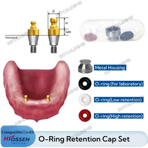 Dental O-Ring Kit Overdenture Retention Ball Abutment Fits Osstem Metal Housing - Picture 1 of 12