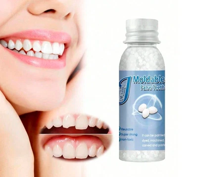 Temporary Tooth Repair Kit Fix Broken Teeth And Fills Gaps Non Toxic uk