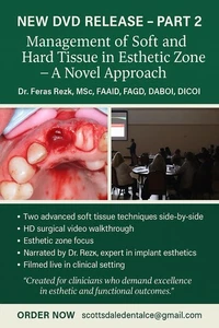 Vascularized Combine Connective Tissue Grafts - Picture 1 of 5