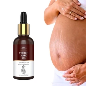 Acne Scar Removal Oil Pimples Stretch Marks Gel Remove Nice 1 fl oz - Picture 1 of 9