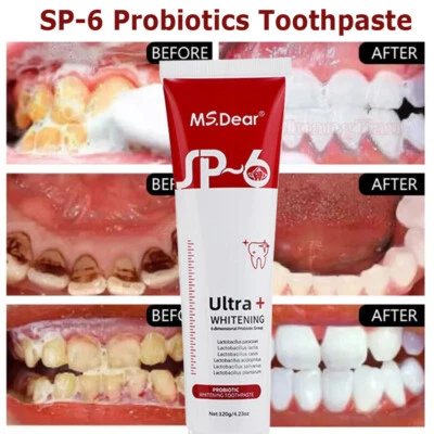 MS.DEAR SP-6 Toothpaste, Whitening SP-6 Toothpaste, SP-6 Probiotic Whitening Toothpaste