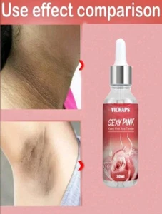 30ml Vichaps Skin Brightening Cream For Private Areas, Armpit, Butt, Knee, Inner - Picture 1 of 3