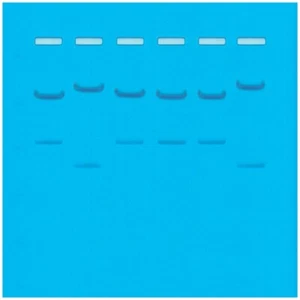DNA Fingerprinting by Restriction Enzyme Patterns - Picture 1 of 3