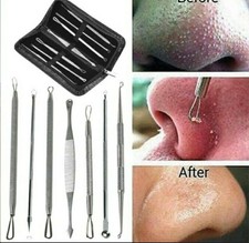 KIT 7 PZ ESTRATTORE REMOVER PUNTI NERI TOOL SET TOGLI PORI MANUALE ACNE D4TMAA