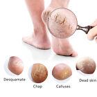 1 Pair Silicone Moisturizing Gel Heel Socks Cracked Foot Skin Care Protectors